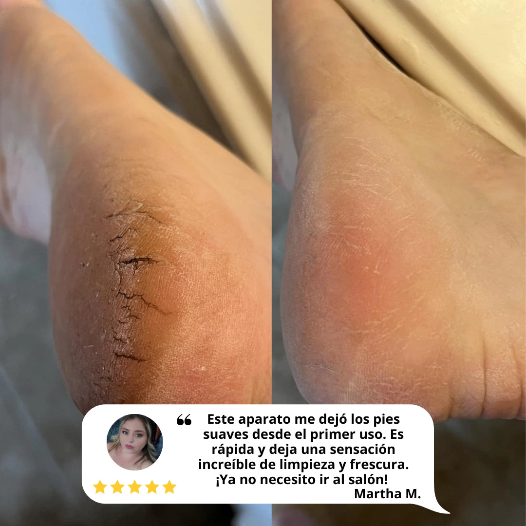 nuvélla™ Silk Pro