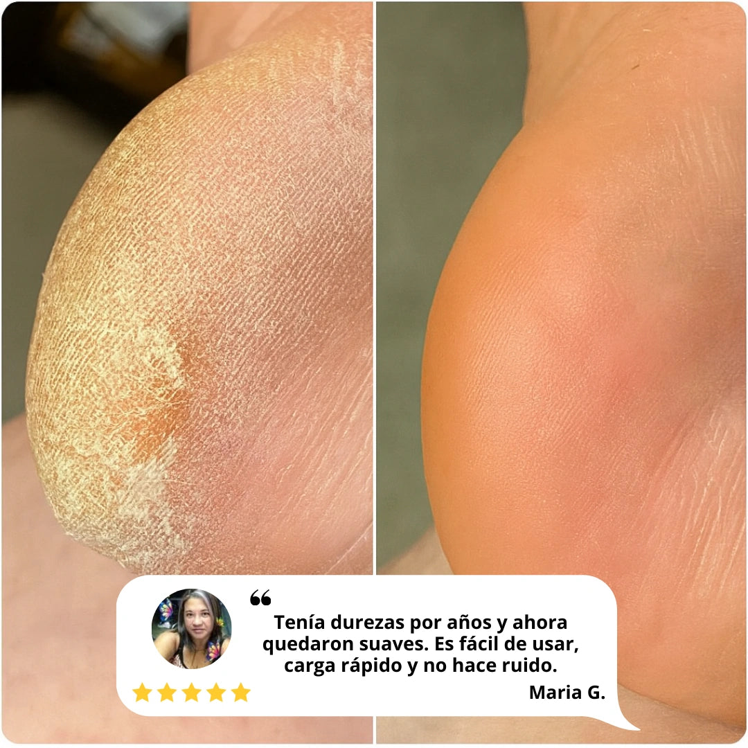 nuvélla™ Silk Pro
